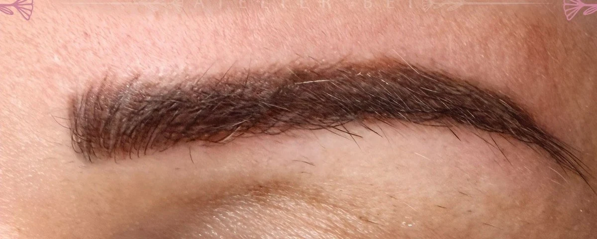 Natural Brow Elevation