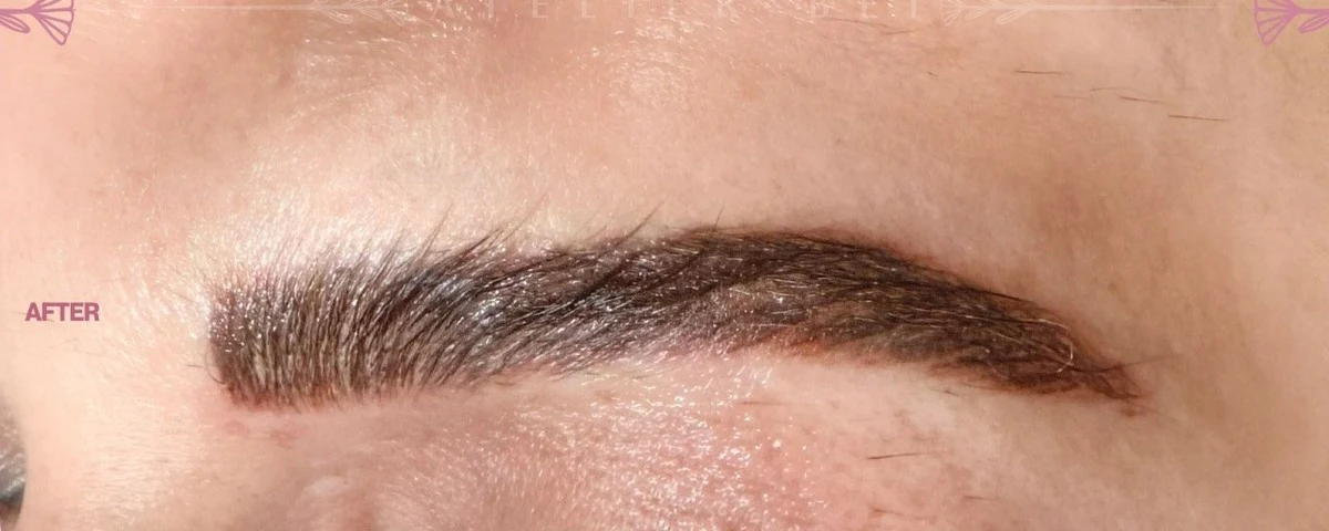 Custom Contour & Balance