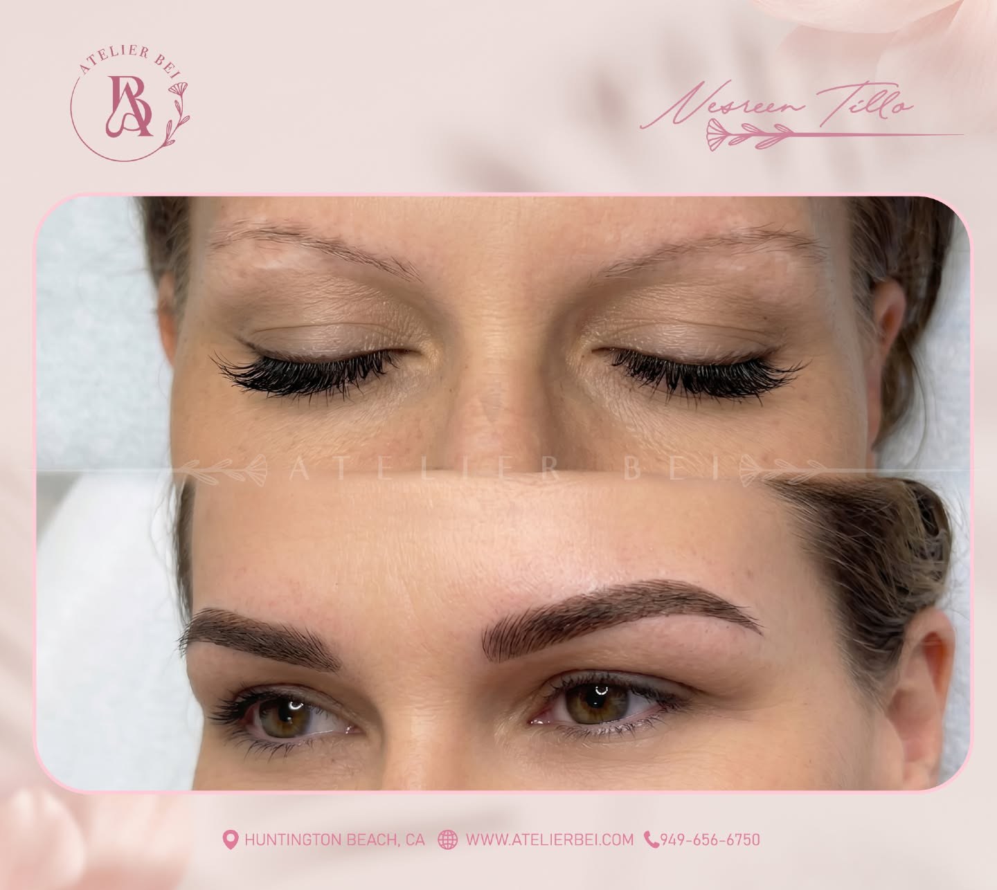3D Microblading Sparse Hairline Reconstruction
